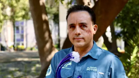 'This Animal Spared My Life': Marine Biologist Survives Shark Attack and Hopes to Meet Again