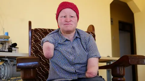 Election Violence: The Fearful Reality for People with Albinism in Tanzania