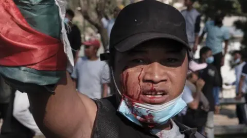Madagascar in Turmoil: Alleged Power Grab Amid Protests